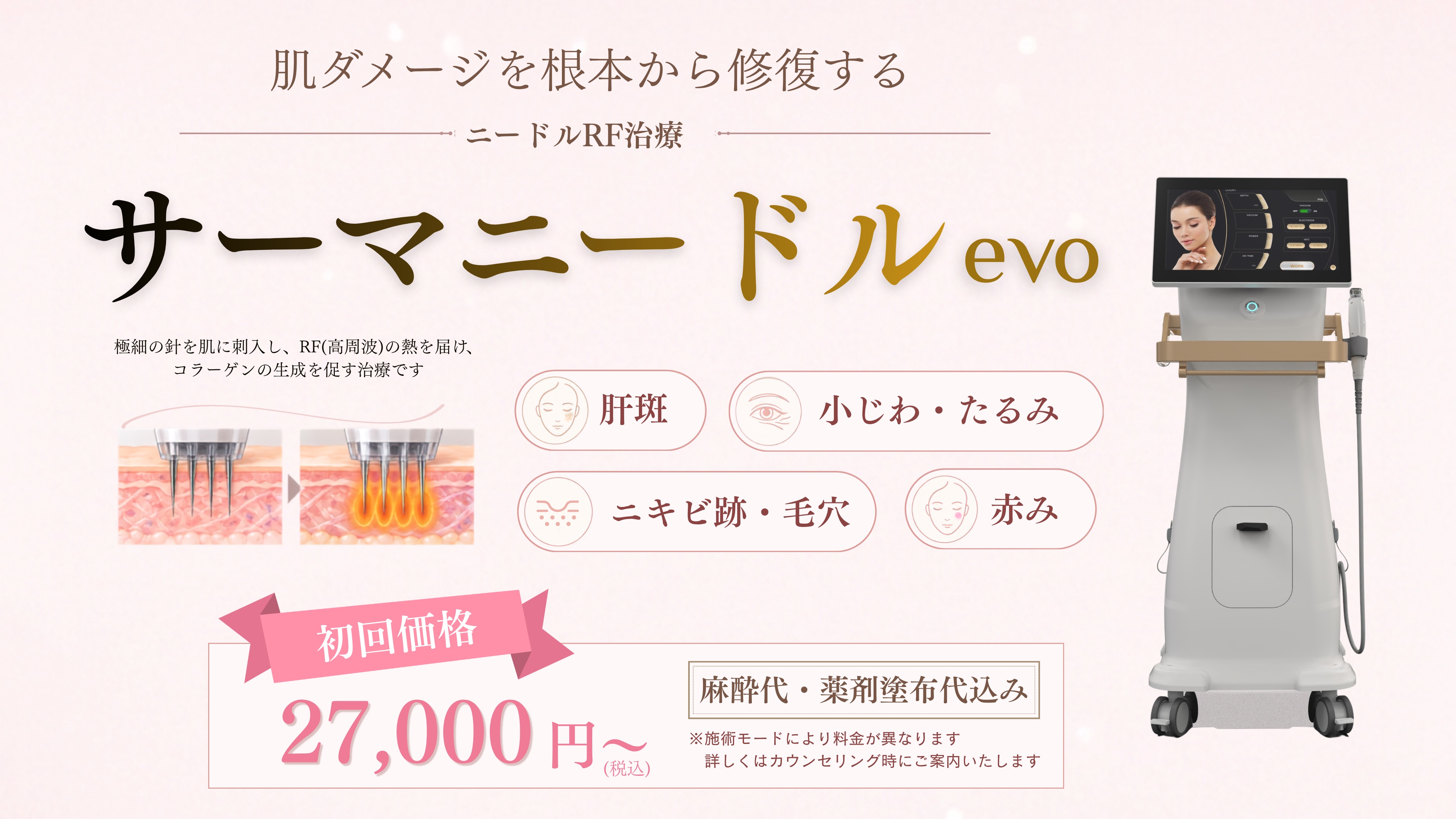 サーマニードルevo